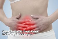Pengertian Gastritis, Tanda, Gejala, Faktor Penyebab