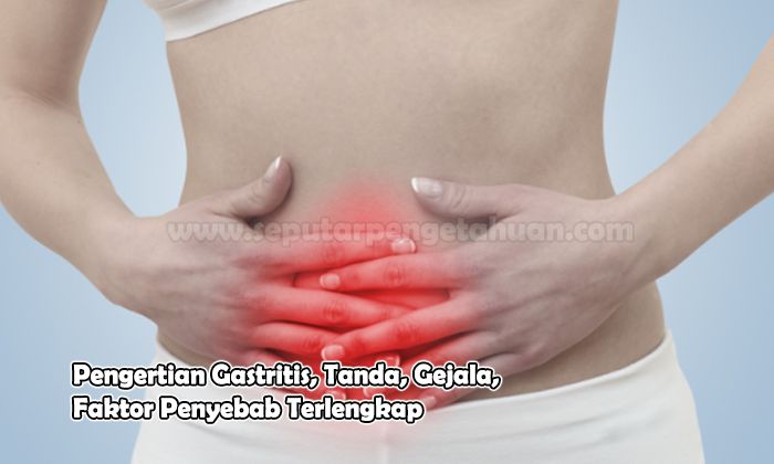 Pengertian Gastritis, Tanda, Gejala, Faktor Penyebab